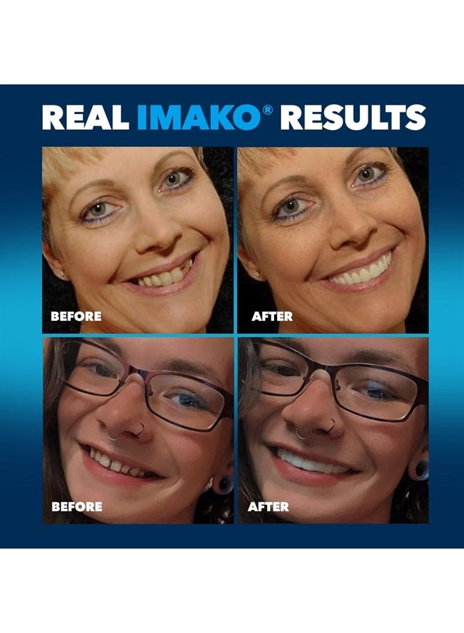 Imako Premium Cosmetic Teeth - 2 Pack - Small, Natural White - Upper Veneers - Custom Fit at Home, DIY Smile Makeover, Made in USA - Image 4