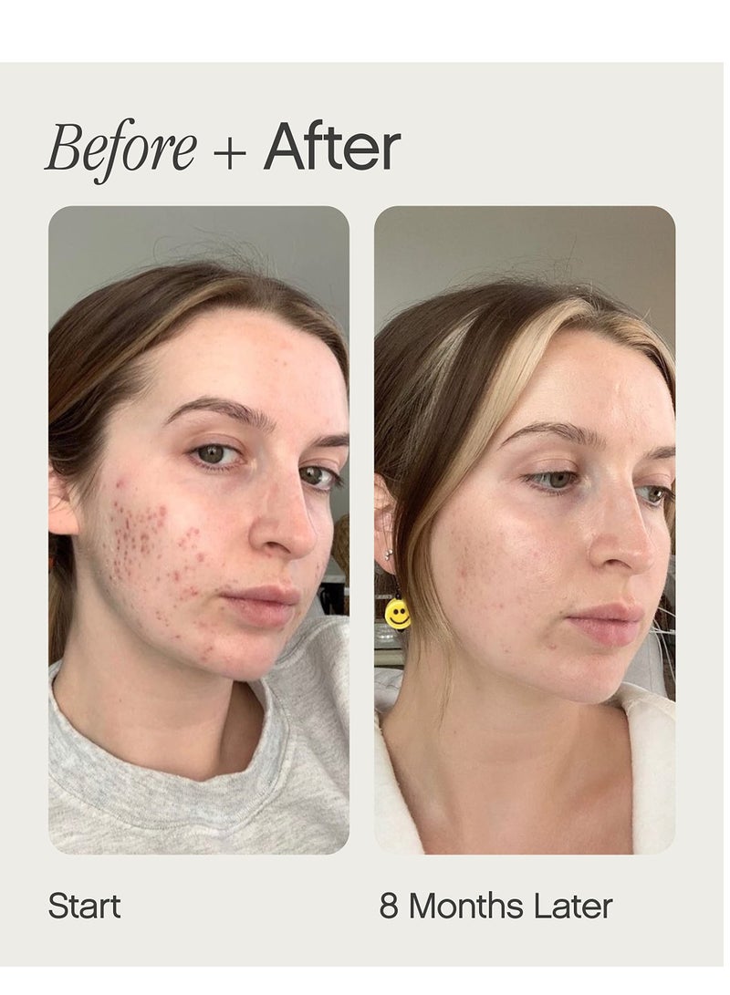 Topicals brightening&clearing serum for uneven skin tone 15ml - Image 4