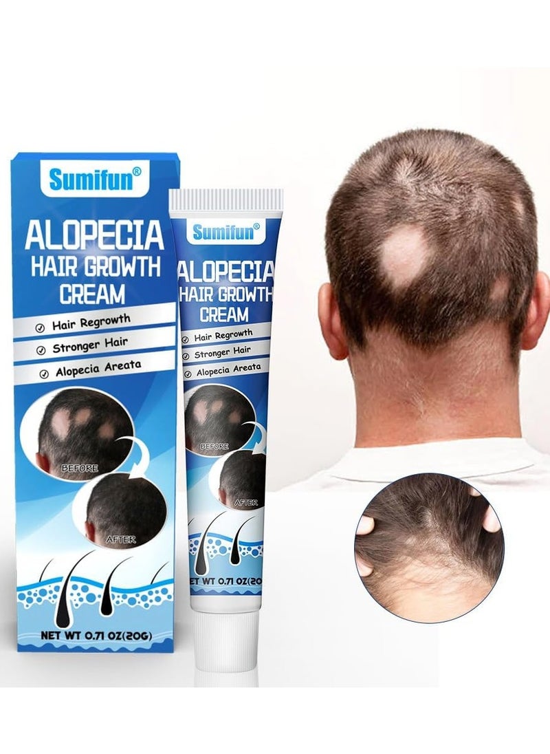 Sumifun - Alopecia Hair Growth Cream, 20g - Revitalizing Scalp and Promoting Hair Growth - Effective Treatment for Alopecia & Thinning Hair - Nourishes & Strengthens Hair Follicles - Reduces Hair Loss - Image 1