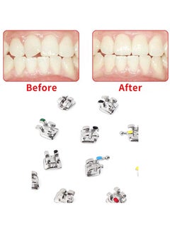 HaLunhi 20 pieces, orthodontic brackets, metal brackets, mini straight wire brackets, without hook, Mini MBT 022 Slot No Hook  - Image 3
