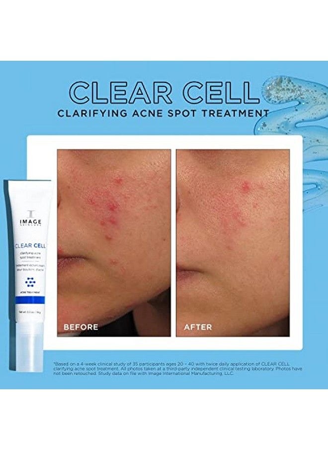 IMAGE SKINCARE - Clear Cell Clarifying Acne Spot Treatment .5Oz 0.5 Oz. - Image 1