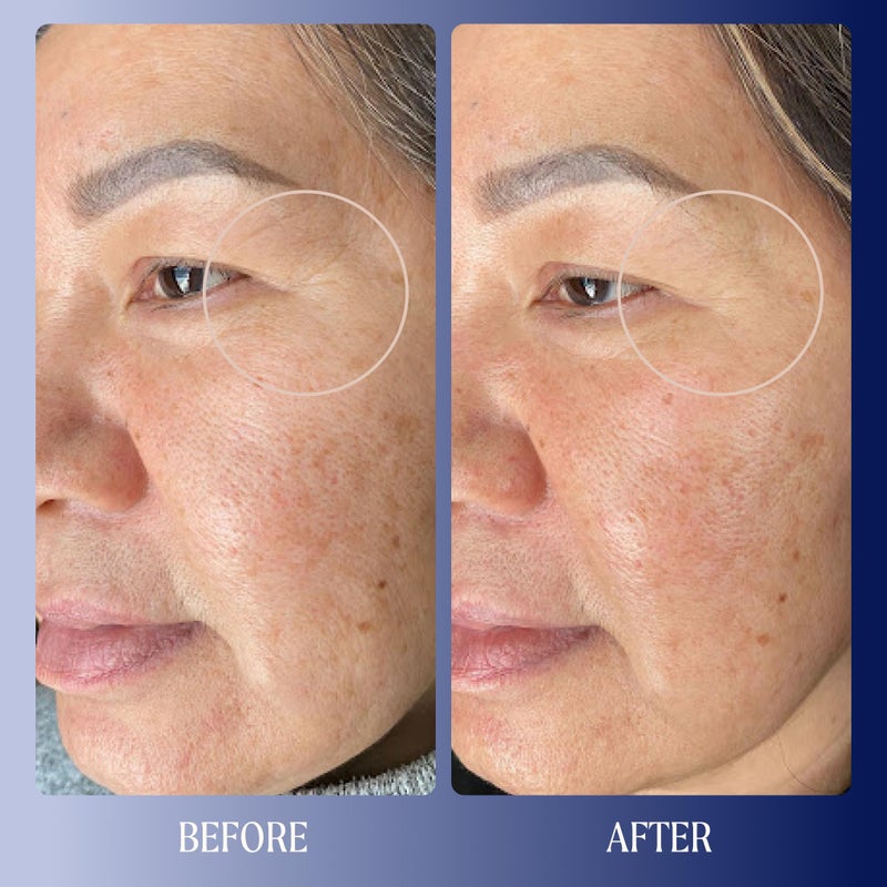 Kinship Dream Wave 2% Bio-Retinoid Overnight Ultra Hydrating Serum for Face | Retinol for Sensitive Skin | Anti Aging Niacinamide + Tranexamic Acid | Smooth Wrinkles | Redness Reducing Skin Care 1 Oz - Image 3