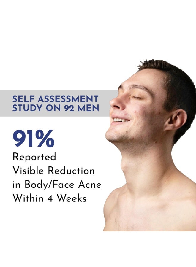 مانليش صابون مانليش المضاد لحب الشباب | يتحكم في الإفرازات الدهنية الزائدة | صابون يدوي الصنع للجسم والوجه للبشرة الدهنية والمعرضة لحب الشباب | 2% حمض الساليسيليك، 2% نياسيناميد، 2% زيت شجرة الشاي | يفتح لون البشرة، ويخفف البقع الداكنة | يمنع ظهور حب الشباب في الجسم | متوازن الحموضة، خالٍ من كبريتات لوريل الصوديوم، تم اختباره من قبل أطباء الجلدية | 150 غرام (عبوة من قطعتين × 75 غرام) - Image 5