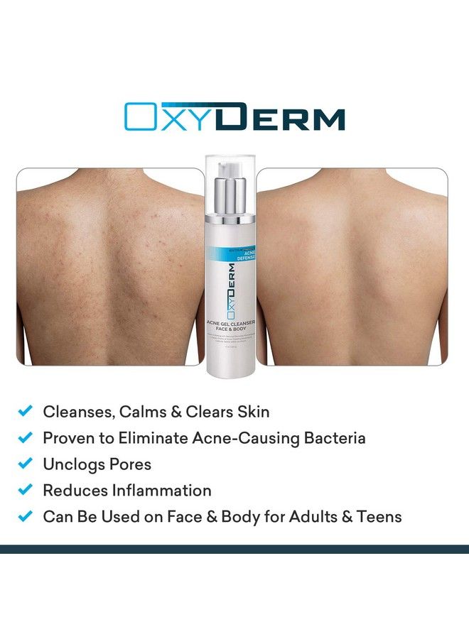 OxyDerm Benzoyl Peroxide 10% Cleanser Wash Treatment Clears Cystic Breakouts & Fights Acne Blemishes on Contact Prevents Future Pimples Blackheads Whiteheads Zits Bumps Face & Body for Teens & Adults - Image 4