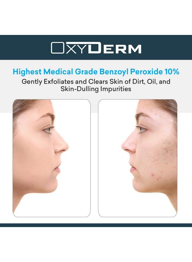 OxyDerm Benzoyl Peroxide 10% Cleanser Wash Treatment Clears Cystic Breakouts & Fights Acne Blemishes on Contact Prevents Future Pimples Blackheads Whiteheads Zits Bumps Face & Body for Teens & Adults - Image 3