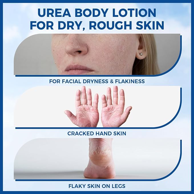 OUKEYA Urea Cream 10% Body Lotion for Dry Chapped Skin, 11.28 Oz - Image 3