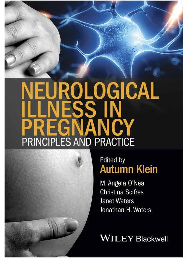 Neurological Illness in Pregnancy: Principles and Practice 