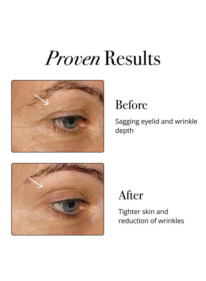 Glotrition Collagen Boost | Skin, Hair, Nails & Joint Support | Reduce Wrinkles and Firm Skin | All-Natural, Non-GMO Collagen for Women & Men 15ct - Image 2