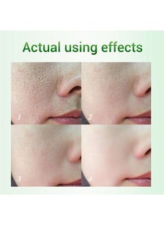 Breylee BREYLEE Pore Refining Serum Shrink Pores Tightens Skin Essence Whitening Moisturizing Anti-Aging Oil Control Facial Essence  - Image 2