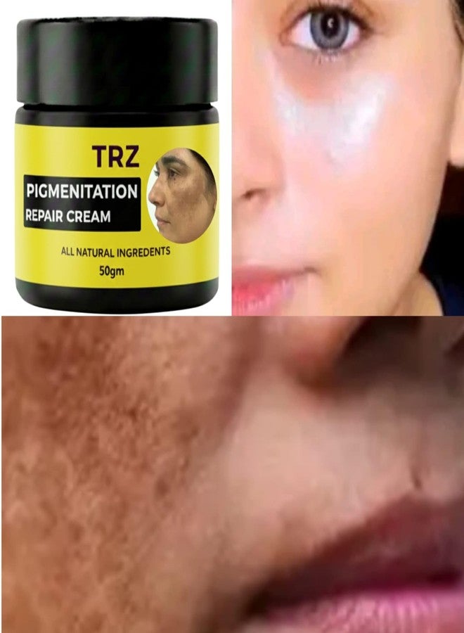 TRZ Bye Bye Pigmentation Cream | Hydrating & Lightweight Formula | For Men & Women | Pack of 1 (50 Gram) TRZ Anti Acne & Hyperpigmentation for Women/Men - Image 3