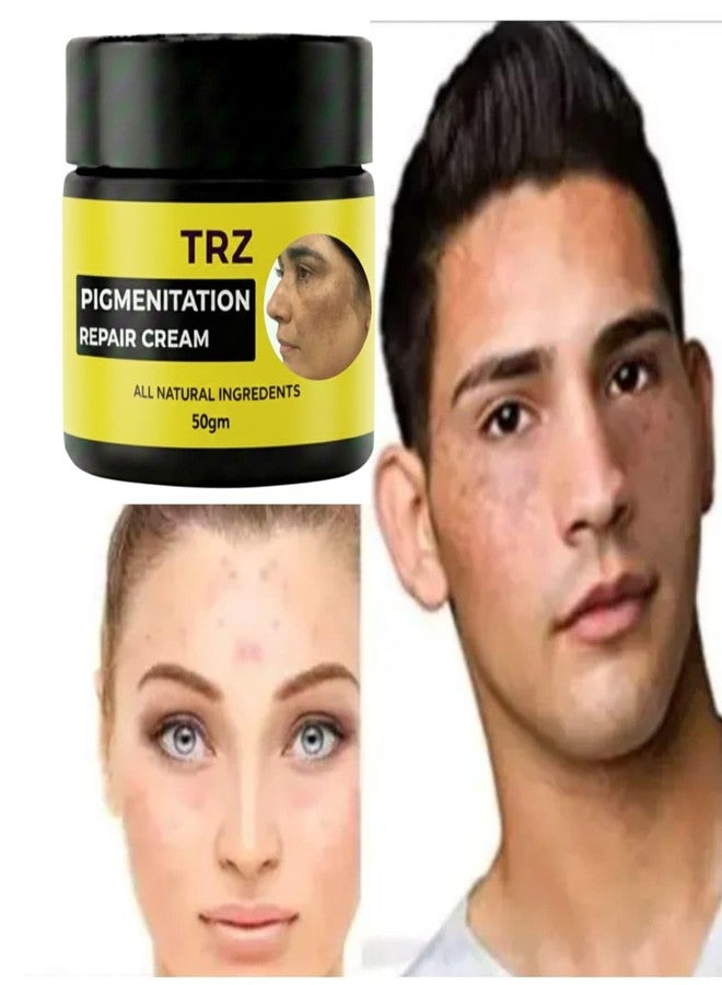TRZ Bye Bye Pigmentation Cream | Hydrating & Lightweight Formula | For Men & Women | Pack of 1 (50 Gram) TRZ Anti Acne & Hyperpigmentation for Women/Men - Image 2