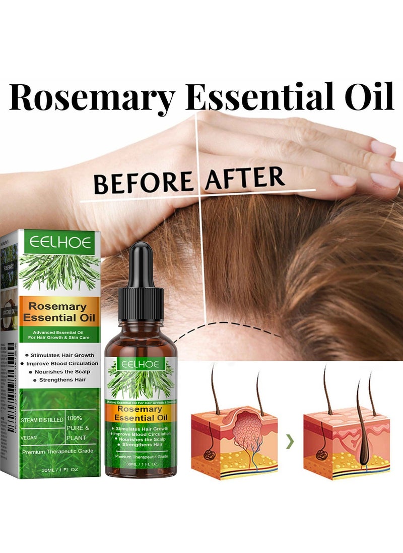 EELHOE 3-PACK Rosemary Hair Oil, Prevents Hair Loss, Nourishes Scalp And Repairs Damaged Hair 30ml*3 - Image 2