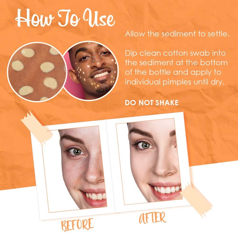 Bye Bye Blemish Dark Spot Lotion Vitamin C | Assists with Drying Blemishes And Brightening Skin | Fast Acting Solution | 1 Fl. Oz. - Image 4