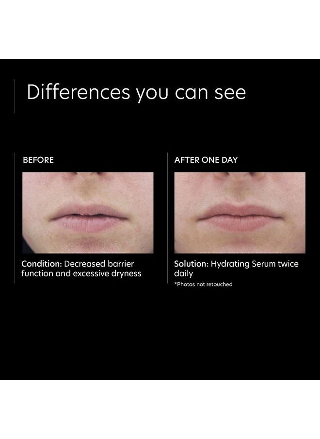 PCA SKIN Hydrating Face Serum - Soothing Anti Aging Facial Treatment with Hyaluronic Acid Sodium and Aloe Vera to Boost Moisture & Minimizes Fine Lines & Wrinkles (1 fl oz)  - Image 4