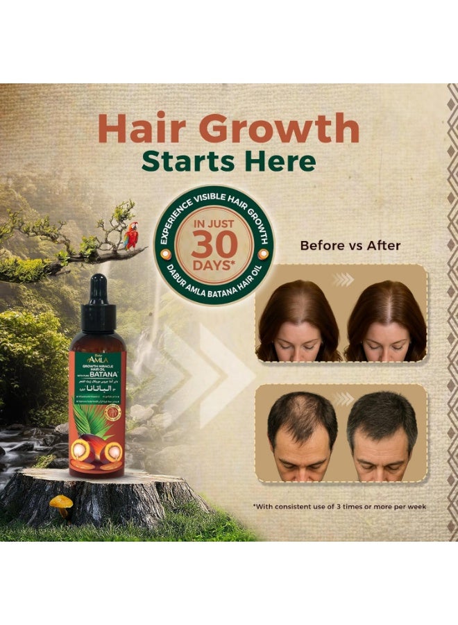 دابر زيت الشعر دابر أملا بيور باتانا معجزة النمو – 95 مل | مع 100% من الباتانا الخام وفيتامين هـ | يعزز نمو الشعر، ويمنع تساقط الشعر ورققه، ويحسن النعومة ويعزز اللمعان | مصدرها أخلاقيا من هندوراس | مناسبة لكل من النساء والرجال - Image 3