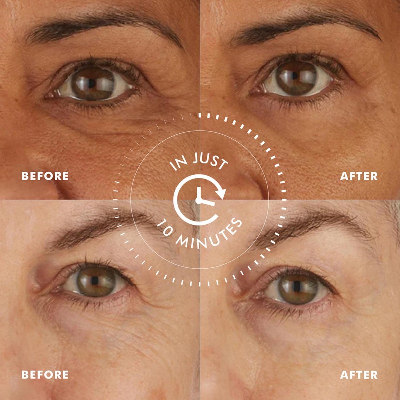 skyn ICELAND Hydro Cool Firming Eye Gels: Under-Eye Gel Patches to Firm, Tone and De-Puff Under-Eye Skin, 8 Pairs - Image 3