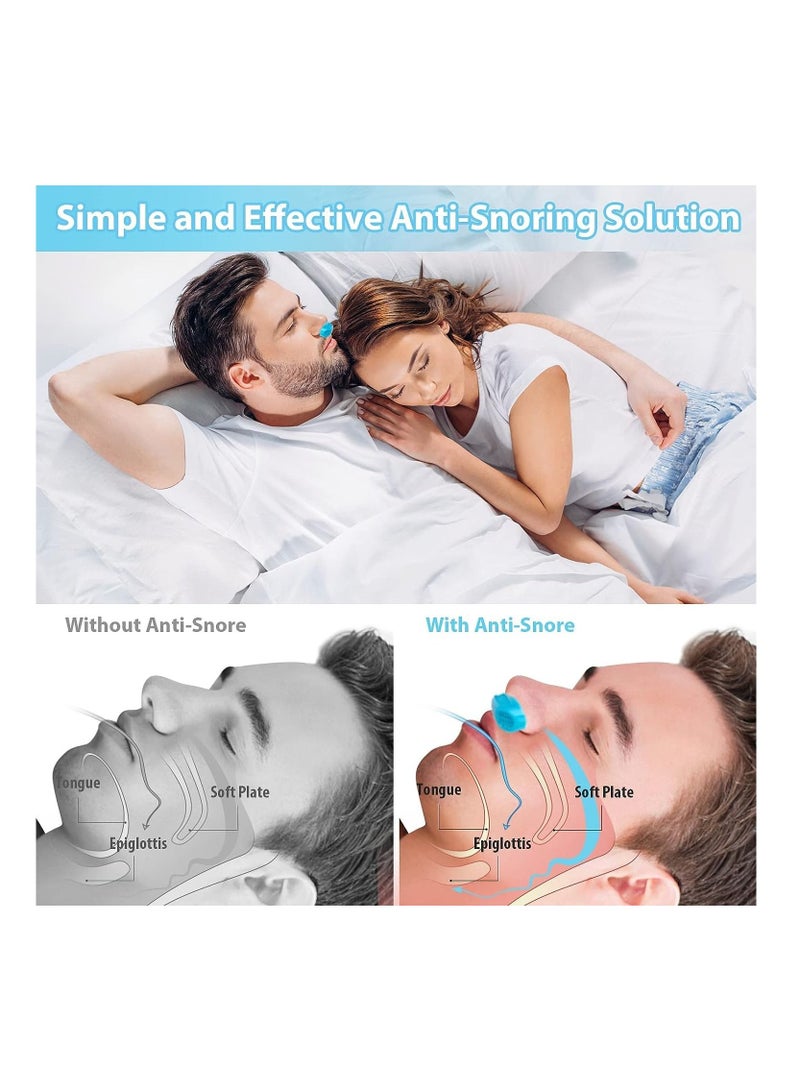 BLOOMING TIME 2-in-1 Snoring Solution Nasal Air Purifier and Dilator for Comfortable Sleep and Improved Breathing - Ideal for Men and Women - Image 3