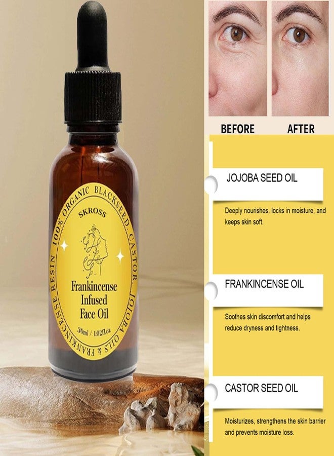 SKROSS 2pcs Frankincense Resin Oil, Frankincense Infused Face Oil, Infused With Organic Black Seed, Castor, And Jojoba Oil, Facial Moisturizing Anti-Aging Serum - Image 3