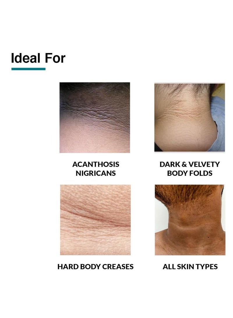 EELHOE cream for Acanthosis Nigricans | Whitening Cream Lightening Cream Underarm Whitening Cream Effective for Armpit Knees Elbows & Knuckles  Dermatologist Tested - 3.52OZ - Image 3