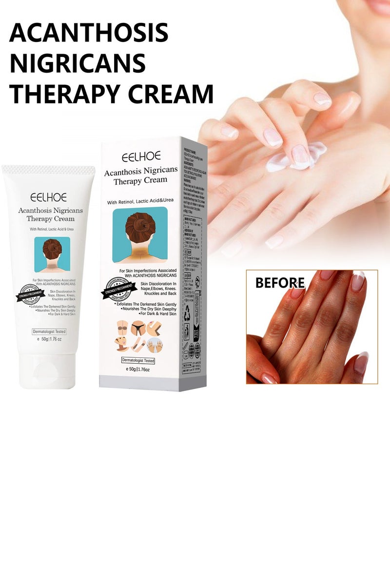 EELHOE cream for Acanthosis Nigricans | Whitening Cream Lightening Cream Underarm Whitening Cream Effective for Armpit Knees Elbows & Knuckles  Dermatologist Tested - 3.52OZ - Image 2
