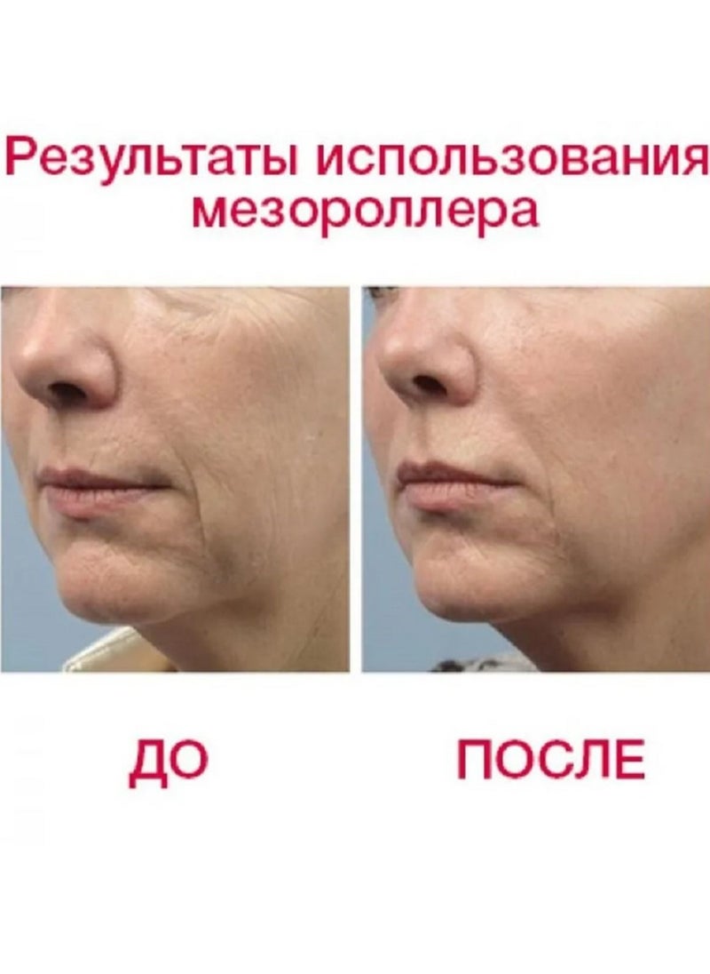 Skin wrinkle removal and improvement device, easy to use, multi-purpose