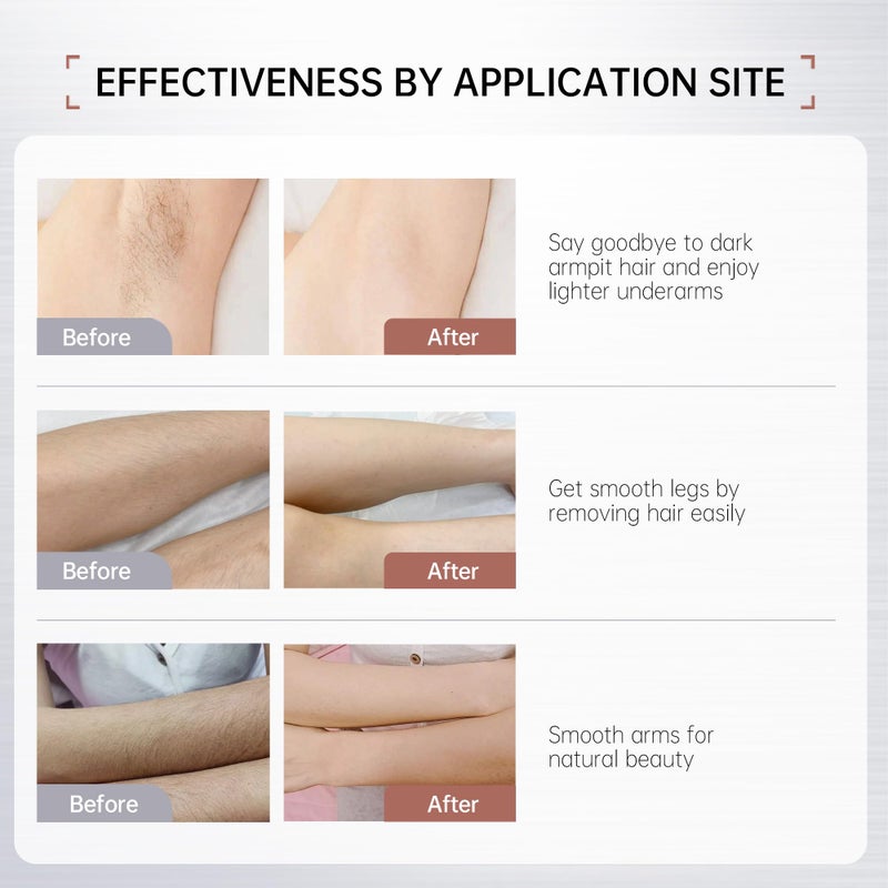 VGO Painless Bikini Gel for Women & Men, Unwanted Hair Removal for All Skin Types, 120ml / 4.06oz - Image 2