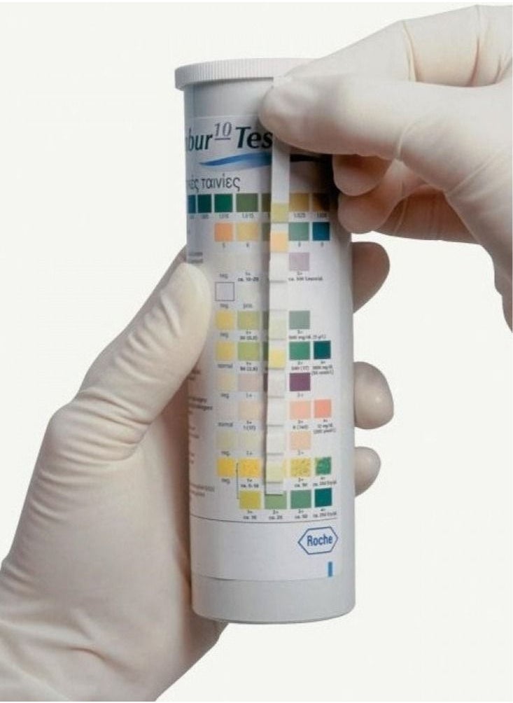 Roche - 10 Parameter Diagnostics Combur 10 Urine Test 100 Pieces Original - Image 1
