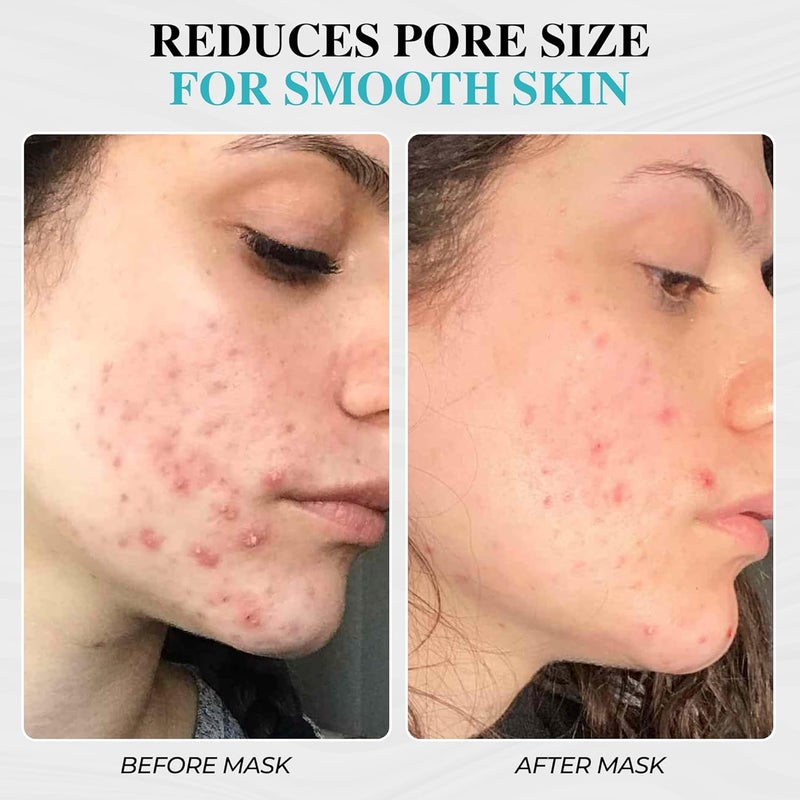 Aromasong 100 Pure Dead Sea Mud Mask for Face and Body Spa Quality Pore Minimizer for Face Oily Skin Cleansing Natural Skin Care for Women and Men 8 oz - Image 5