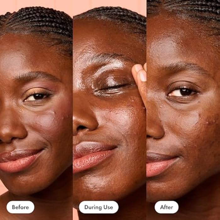 HERO COSMETICS Dissolve Away Daily Cleansing Balm - Helps Remove Makeup and Grime - Won’t Clog Pores - Suitable for Sensitive and Acne-Prone Skin (2.2 fl oz) - Image 4