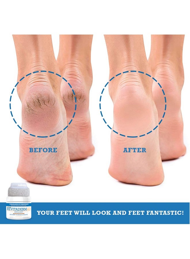 كريم القدم ريفيتاديرم 4D يوريا يرطب بعمق للأقدام الجافة والمتشققة واليدين والمرفقين والركبتين، كريم إصلاح فائق ومزيل مسامير القدم للقدمين، خالٍ من حجر الخفاف متضمن 118 مل. 1 حزمة - Image 4