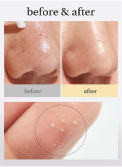 NOONI NOONI Korean Cleansing Oil - Snow Aqua 0 LHA Toning Pore Care Korean Facial Oil Cleanser, 6.76 fl.oz | Makeup Double Cleansing, Glass Skin, Eggie Skin, Blackhead Control, Pore Cleansing Oil for Face  - Image 2