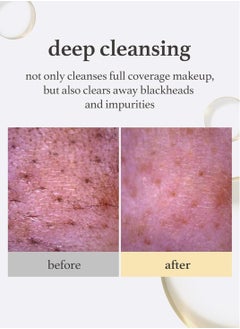 NOONI NOONI Korean Cleansing Oil - Snow Aqua 0 LHA Toning Pore Care Korean Facial Oil Cleanser, 6.76 fl.oz | Makeup Double Cleansing, Glass Skin, Eggie Skin, Blackhead Control, Pore Cleansing Oil for Face  - Image 4
