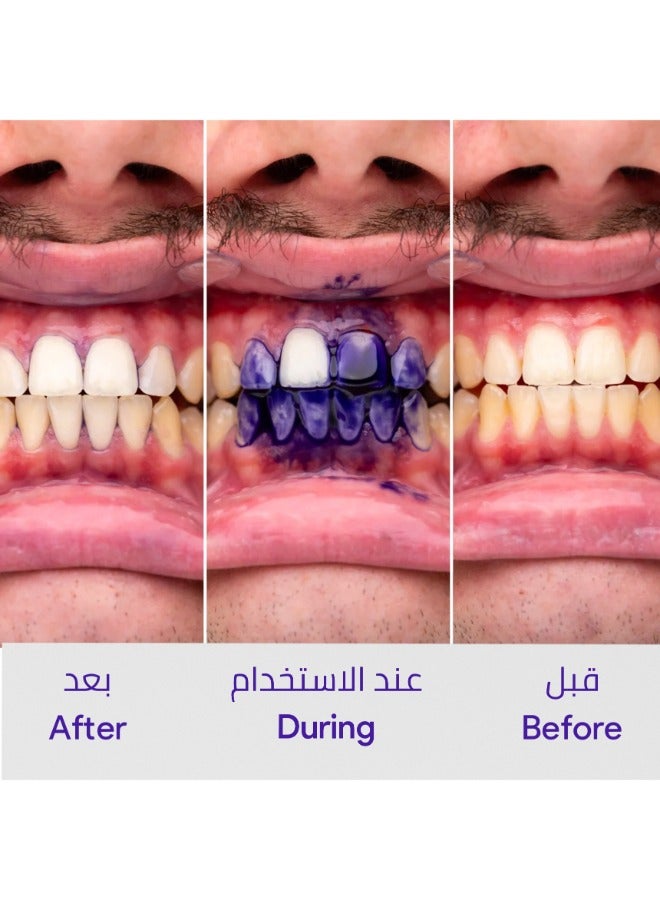 v34 Teeth Color Corrector Serum (Viral) 30ml