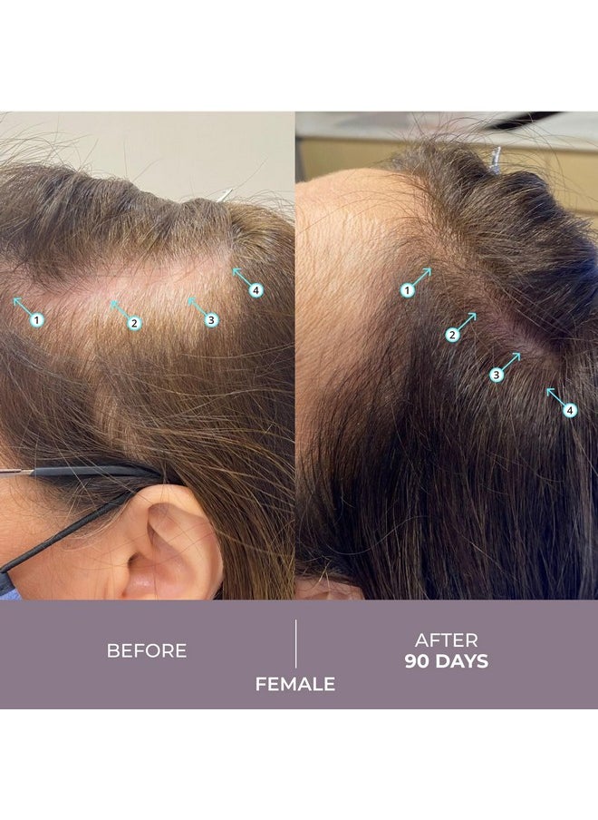 DS LABORATORIES Spectral.Csf Hair Regrowth Treatment For Women - Biotin Serum For Hair Growth, Thinning, And Thickening 
