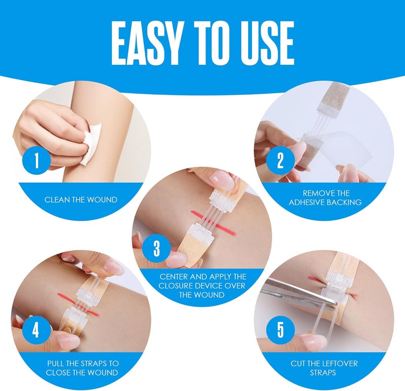 Houseables Butterfly Bandages Wound Closure Strips Laceration Closure Strips Butterfly Stitches for Wounds Zip Stitch Bandage Emergency Laceration Kit Zip Sutures Emergency Skin Zipper 4 Pack - Image 4