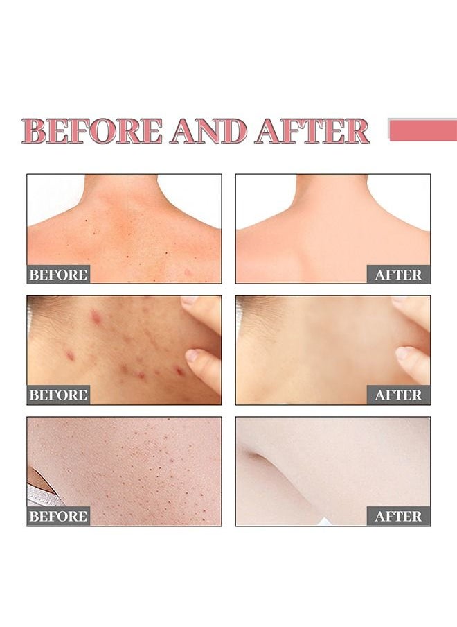 Jaysuing Vitalizing salicylic acid scrub soap, pore exfoliating, softening skin, anti-blemishes, removing acne, exfoliating, desalting acne mark moisturizing skin Cleansing soap Shower soap  - Image 4