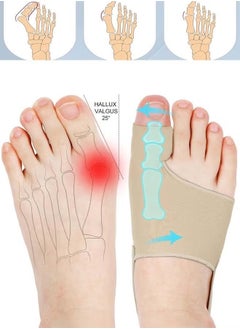 Bukela Bunion Corrector Orthopedic Splint Big Toe Separator Pain Relief Non-Surgical Hallux Valgus Correction Straightener for Women Men Day Night Support 1 Pair  - Image 1