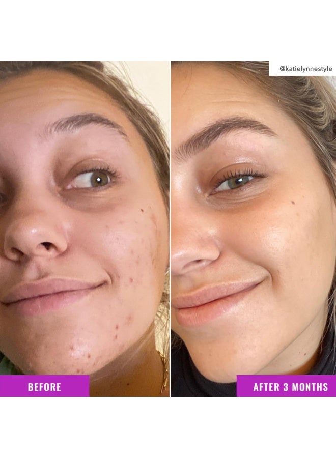 Good Molecules Niacinamide Brightening Toner - Toner for Face with Niacinamide and Arbutin for Skin Tone Balancing- Pore Minimizer, Facial Skin Care - Image 4