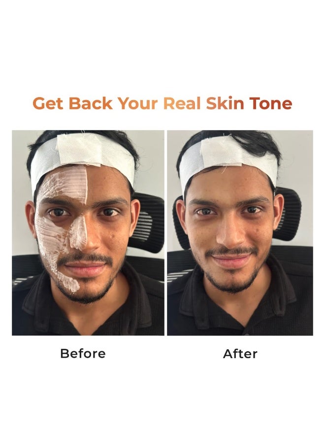 Niconi Tan Vanish Gluta-Kojic Skin Polish | Instant Tan Removal & Glow | Infused with Kojic Acid & Glutathione | Ideal for All Skin Types | Lightens Suntan | 180g - Image 3