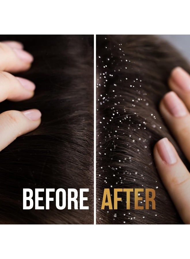 Pantene شامبو بانتين برو-في ضد القشرة 2 في 1 200 مل - Image 5