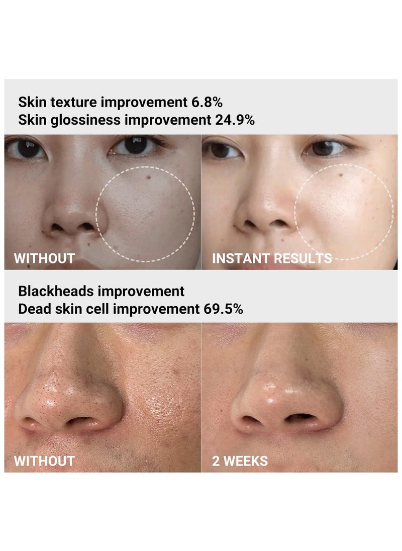 Medicube - Medicube Age-R ATS Air Shot - Microneedling Skin Care Device for Pore Tightening, Enhanced Absorption, and Smoother Skin Texture - Exfoliation and Skin Rejuvenation - Korean Skincare - Image 1