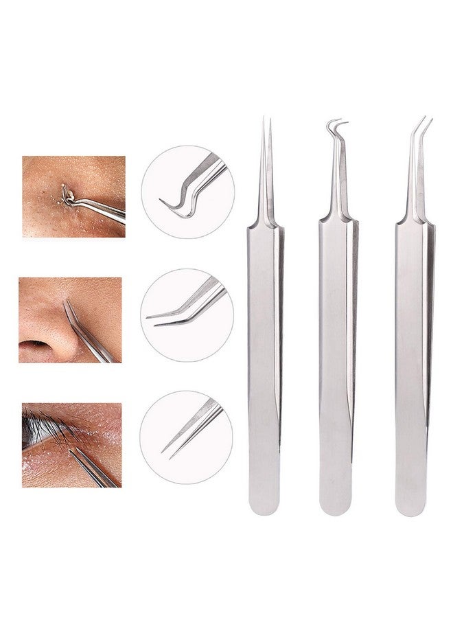 WSYUB Blackhead Remover Comedone Extractor 3 In 1 Professional Stainless Skin Zit Acne Blemish Whitehead Popping Removing Surgical Tools Set Silver - Image 3