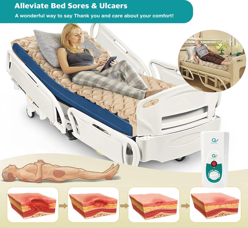 Q DEVICES Anti-Decubitus Air Mattress with Electric Pump for Bedsore Prevention – Alternating Pressure Medical Grade Bubble Pad for Patients, Beige - 1 Year Replacement Warranty - Image 4