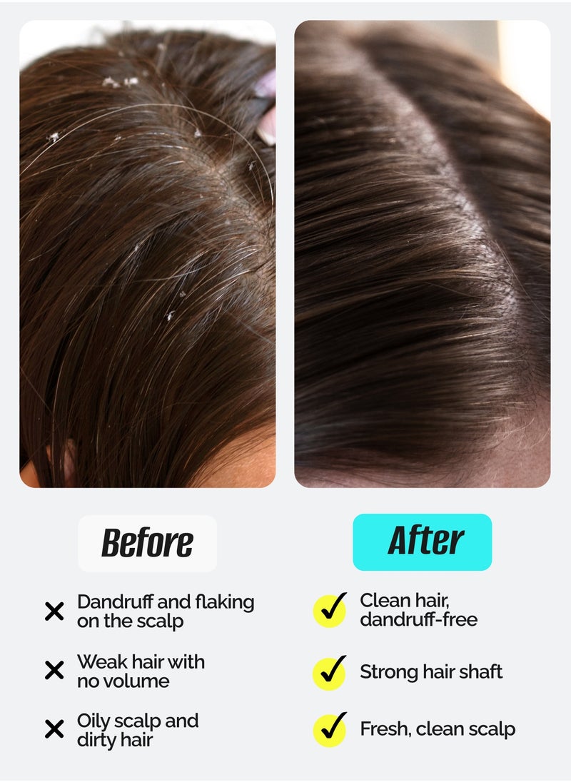 Anti-dandruff Peeling Shampoo