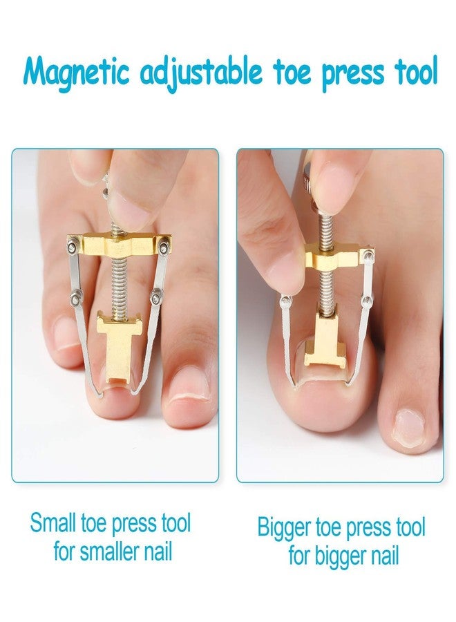 jeoga Professional Ingrown Toenail Fixer - Adjustable Stainless Steel Toe Nail Correction Tool with Screw Mechanism for Severe Ingrown Toenail Relief, Pain-Free Pedicure Kit for Men & Women - Image 4
