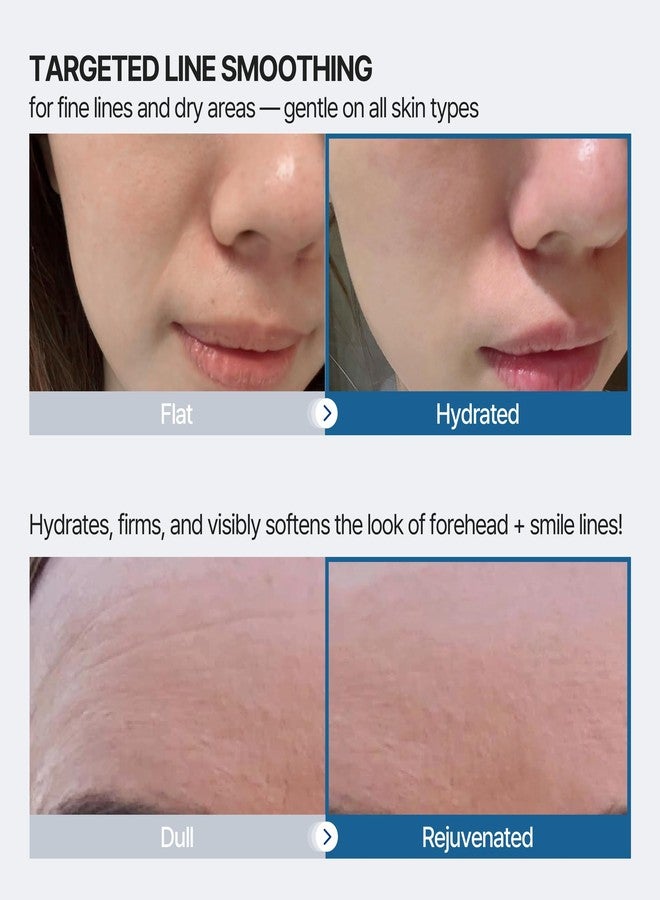 Honeydew Labs لصقات مضادة للتجاعيد للجبهة وخطوط الابتسامة، 18 قطعة، تحتوي على حمض الهيالورونيك والكولاجين والببتيدات - لصقات مضادة للتجاعيد - شريط لاصق للوجه للتجاعيد طوال الليل - تنعيم البشرة وشدها وترطيبها - Image 3