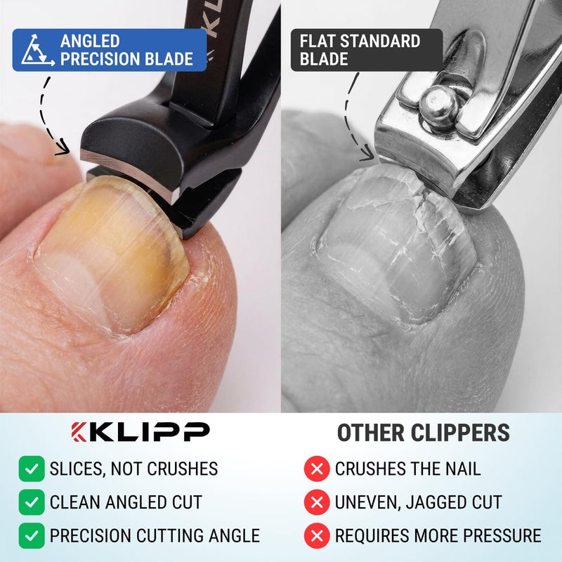 KLIPP Toenail Clippers for Thick Toenails â€“ KLIPP 15 mm Wide Jaw Thick Fingernail and Toenail Cutter with Curved Stainless-Steel Blades for Seniors (Angled Wide Opening) - Image 3