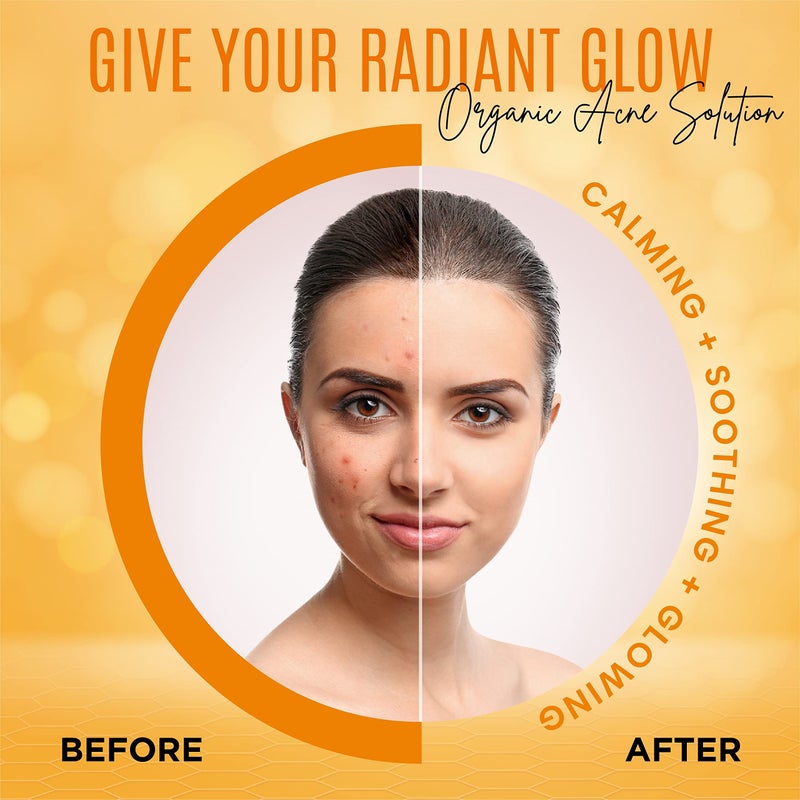 dermaxgen صابون الكركم العضوي | عناية بالبشرة طبيعية وصنع يدوي خالص، منظف للوجه والجسم | التحكم في العيوب، تقليل حب الشباب، توحيد اللون، تلاشي الندوب، أضرار الشمس، بقع الشيخوخة - 3.5 أونصة - Image 5