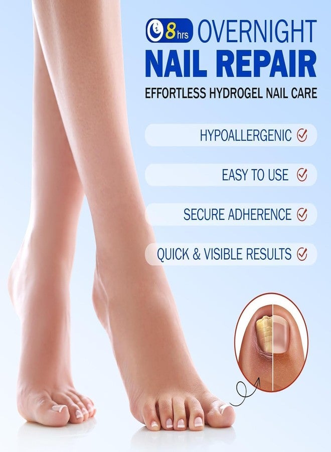 KNVBIN Original 21 pcs Over-Night Renewal Nail Treatment Patches Hydrogel Nail Care Fast Effective Nail Repair Patches (PACK OF 1) - Image 2