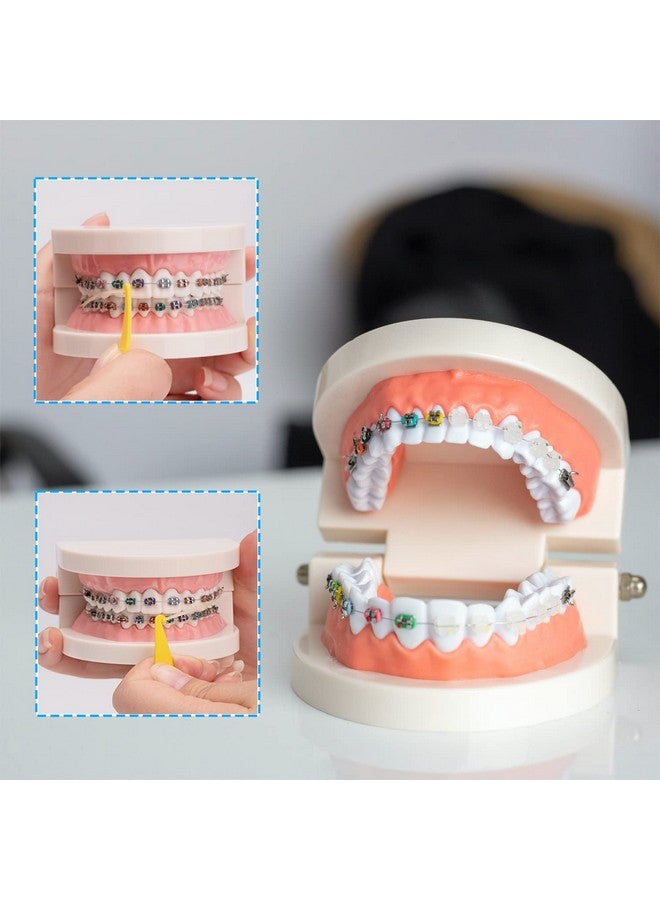 OBTANIM 100 Pcs Colorful Disposable Plastic Braces Elastic Rubber Bands Placers Tool For Braces Dental Orthodontic - Image 5